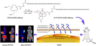 Pre-Clinical Study of the [18F]AlF-Labeled HER2 Affibody for Non-Invasive HER2 Detection in Gastric Cancer